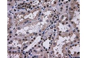 Immunohistochemical staining of paraffin-embedded thyroid tissue using anti-L1CAMmouse monoclonal antibody. (L1CAM anticorps)