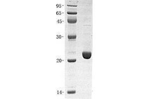 Validation with Western Blot