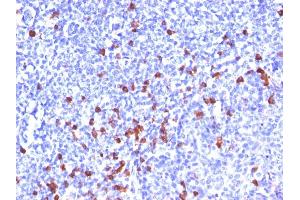 Formalin-fixed, paraffin-embedded human Tonsil stained with IgG Monoclonal Antibody (SPM556) (IGHG anticorps)