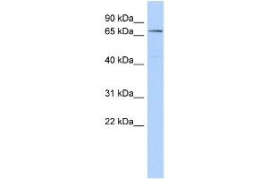WB Suggested Anti-CLPB Antibody Titration: 0. (CLPB anticorps  (Middle Region))
