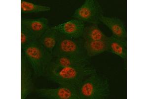 IF analysis of TULP3 using anti-TULP3 antibody (ABIN7602191) and anti-Tubulin Alpha antibody (ABIN7600339). (TULP3 anticorps  (AA 62-362))