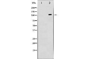Western blot analysis of HDAC6 expression in HepG2 whole cell lysates,The lane on the left is treated with the antigen-specific peptide. (HDAC6 anticorps  (N-Term))