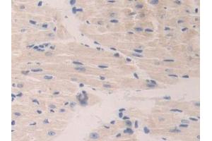 IHC-P analysis of Mouse Heart Tissue, with DAB staining. (CTSA anticorps  (AA 215-470))