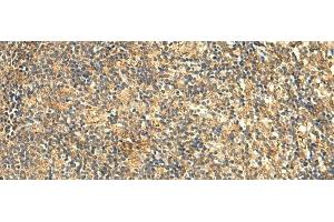 Immunohistochemistry of paraffin-embedded Human tonsil tissue using KIAA0513 Polyclonal Antibody at dilution of 1:50(x200) (KIAA0513 anticorps)