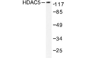 Image no. 2 for anti-Histone Deacetylase 5 (HDAC5) antibody (ABIN265457) (HDAC5 anticorps)