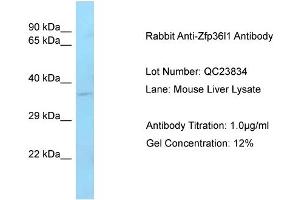 Host: Rabbit Target Name: Zfp36I1 Sample Type: Mouse Liver Antibody Dilution: 1. (ZFP36L1 anticorps  (C-Term))