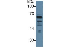 Detection of LCAT in Human PC3 cell lysate using Polyclonal Antibody to Lecithin Cholesterol Acyltransferase (LCAT) (LCAT anticorps  (AA 290-432))