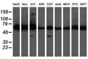 Image no. 4 for anti-Diphthamide Biosynthesis Protein 2 (DPH2) antibody (ABIN1497893) (DPH2 anticorps)