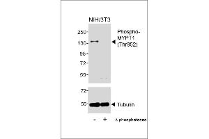 Western blot analysis of lysates from NIH/3T3 cell line, untreated or treated with λ phosphatases, 30 min, using Phospho-MYPT1 (Thr852) Antibody (upper) or Tubulin (lower). (PPP1R12A anticorps  (pThr852))