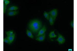 Immunofluorescence staining of HepG2 cells with ABIN7144476 at 1:50, counter-stained with DAPI.