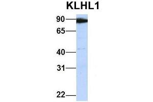 Host:  Rabbit  Target Name:  KLHL1  Sample Type:  Human 721_B  Antibody Dilution:  1. (KLHL1 anticorps  (Middle Region))
