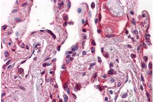 Human Lung: Formalin-Fixed, Paraffin-Embedded (FFPE)