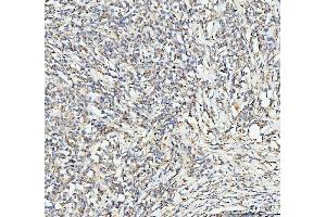 IHC analysis of EDC4 using anti-EDC4 antibody (ABIN7599694).