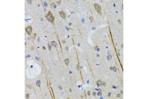 Immunohistochemistry of paraffin-embedded mouse brain using HTR3A antibody.