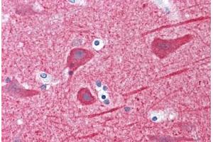 Human Brain, cortex: Formalin-Fixed, Paraffin-Embedded (FFPE)