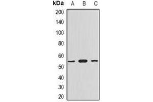 Western blot analysis of Myotilin expression in HepG2 (A), mouse heart (B), rat heart (C) whole cell lysates. (Myotilin anticorps)