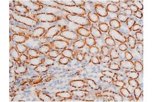 ABIN6267523 at 1/200 staining Mouse kidney tissue sections by IHC-P.