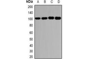 Western blot analysis of GLUR3 expression in U251 (A), PC3 (B), mouse brain (C), mouse lung (D) whole cell lysates. (Glutamate Receptor 3 anticorps)