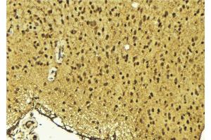 ABIN6275645 at 1/100 staining Mouse brain tissue by IHC-P. (TSEN54 anticorps  (Internal Region))