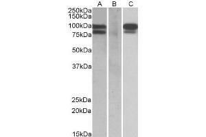 HEK293 lysate (10ug protein in RIPA buffer) overexpressing Human PCSK9 with C-terminal MYC tag probed with ABIN570919 (0.