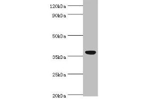 Western blot All lanes: CD5L antibody at 3 μg/mL + A431 whole cell lysate Secondary Goat polyclonal to rabbit IgG at 1/10000 dilution Predicted band size: 38 kDa Observed band size: 38 kDa (CD5L anticorps  (AA 20-347))