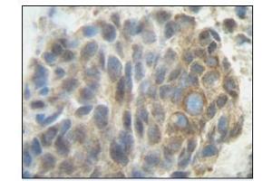 Image no. 1 for anti-Placenta Growth Factor (PGF) antibody (ABIN181639) (PLGF anticorps)