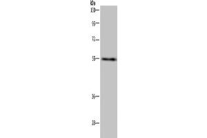 Western Blotting (WB) image for anti-IMP (Inosine 5'-Monophosphate) Dehydrogenase 2 (IMPDH2) antibody (ABIN2423659) (IMPDH2 anticorps)