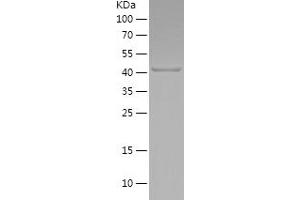 Western Blotting (WB) image for SRY (Sex Determining Region Y)-Box 2 (SOX2) (AA 129-317) protein (His-IF2DI Tag) (ABIN7125200)