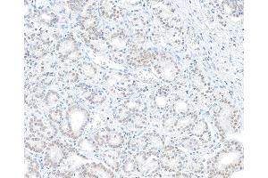 Immunohistochemistry (IHC) image for anti-BRCA1 Associated Protein-1 (Ubiquitin Carboxy-terminal Hydrolase) (BAP1) (AA 500-550) antibody (ABIN7454439)