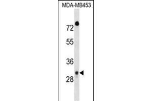 DP1 Antibody (C-term) 17383b western blot analysis in MDA-M cell line lysates (35 μg/lane). (DAPP1 anticorps  (C-Term))