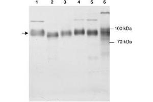Western blot analysis of Scarb2 in various samples using Scarb2 polyclonal antibody . (SCARB2 anticorps)