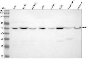 Western blot analysis of KDM1B using anti-KDM1B antibody (ABIN7605748).