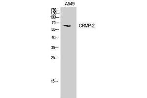 Western Blotting (WB) image for anti-Dihydropyrimidinase-Like 2 (DPYSL2) (Ser306), (Ser309) antibody (ABIN3179981) (DPYSL2 anticorps  (Ser306, Ser309))