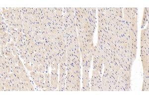 Detection of MAPK9 in Human Cardiac Muscle Tissue using Polyclonal Antibody to Mitogen Activated Protein Kinase 9 (MAPK9)