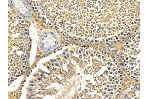 ABIN6257331 and ABIN6275242 at 1/100 staining rat testis tissue by IHC-P. (MRPL3 anticorps  (N-Term))
