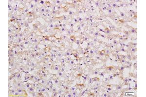 Formalin-fixed and paraffin embedded rat liver labeled with Anti AGT Polyclonal Antibody,Unconjugated (ABIN724115) at 1:200 followed by conjugation to the secondary antibody and DAB staining.