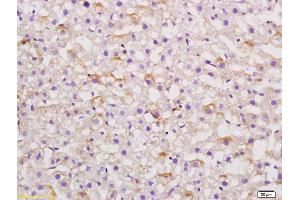 Formalin-fixed and paraffin embedded rat liver labeled with Anti AGT Polyclonal Antibody,Unconjugated (ABIN724115) at 1:200 followed by conjugation to the secondary antibody and DAB staining. (AGT anticorps  (AA 51-110))