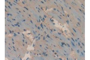 Detection of APOH in Mouse Heart Tissue using Polyclonal Antibody to Apolipoprotein H (APOH)