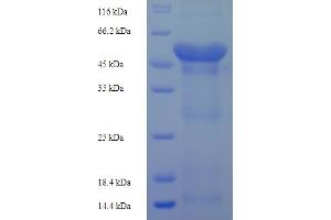 SDS-PAGE (SDS) image for F-Box and Leucine-Rich Repeat Protein 18 (FBXL18) (AA 1-365), (Isoform 3) protein (His-SUMO Tag) (ABIN5709505)