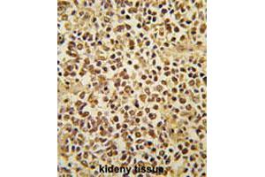 Formalin-fixed and paraffin-embedded human kidney tissue reacted with SNAI1 polyclonal antibody  , which was peroxidase-conjugated to the secondary antibody, followed by AEC staining. (SNAIL anticorps  (AA 9-39))