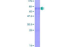 Image no. 1 for Calcium Binding tyrosine-(Y)-phosphorylation Regulated (CABYR) (AA 1-379) protein (GST tag) (ABIN1347812)