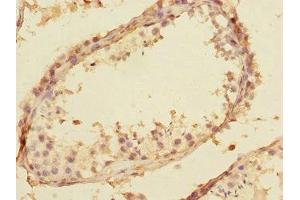Immunohistochemistry of paraffin-embedded human testis tissue using ABIN7170630 at dilution of 1:100
