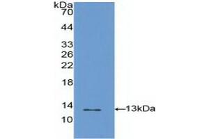 Detection of Recombinant S100A4, Human using Polyclonal Antibody to S100 Calcium Binding Protein A4 (S100A4) (s100a4 anticorps  (AA 2-101))