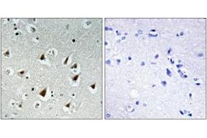 Immunohistochemistry analysis of paraffin-embedded human brain tissue, using ZHX2 Antibody. (ZHX2 anticorps  (AA 751-800))
