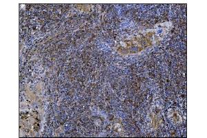 IHC analysis of POGLUT1 using anti-POGLUT1 antibody (ABIN7602910). (POGLUT1 anticorps  (C-Term))