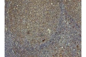 (ABIN185256) (3 μg/mL) staining of paraffin embedded Human Tonsil.