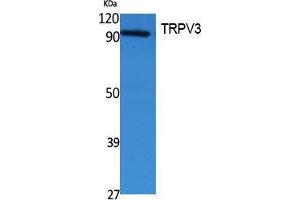 Western Blotting (WB) image for anti-Transient Receptor Potential Cation Channel, Subfamily V, Member 3 (TRPV3) (Internal Region) antibody (ABIN3187651) (TRPV3 anticorps  (Internal Region))