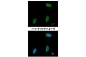 ICC/IF Image Immunofluorescence analysis of paraformaldehyde-fixed human pancreatic cancer cell line, using ERG, antibody at 1:50 dilution.