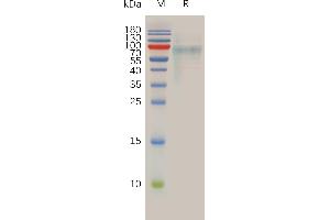 Human LIV-1 Protein, His Tag on SDS-PAGE under reducing condition.