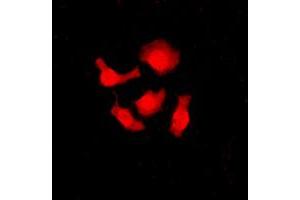 Immunofluorescent analysis of SRSF3 staining in HeLa cells. (SRSF3 anticorps  (C-Term))